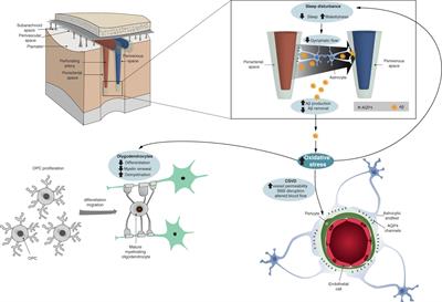 Is Oxidative Stress the Link Between Cerebral Small Vessel Disease, Sleep Disruption, and Oligodendrocyte Dysfunction in the Onset of Alzheimer’s Disease?